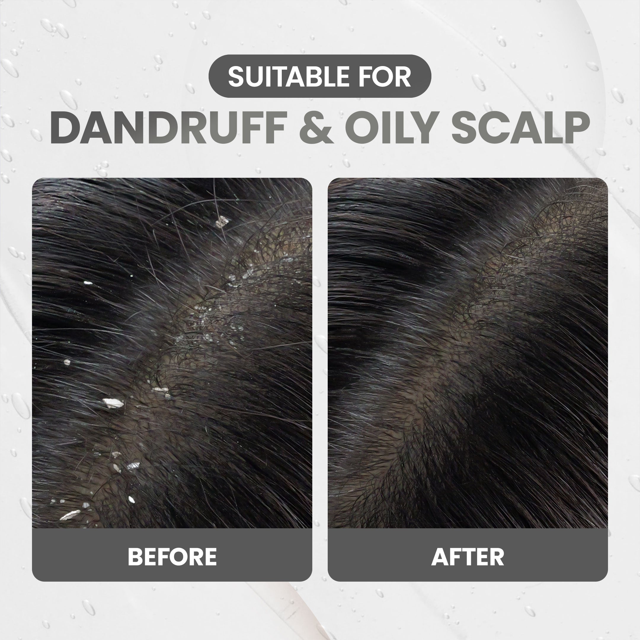 OSWEET Anti-Dandruff & Oil Control Shampoo