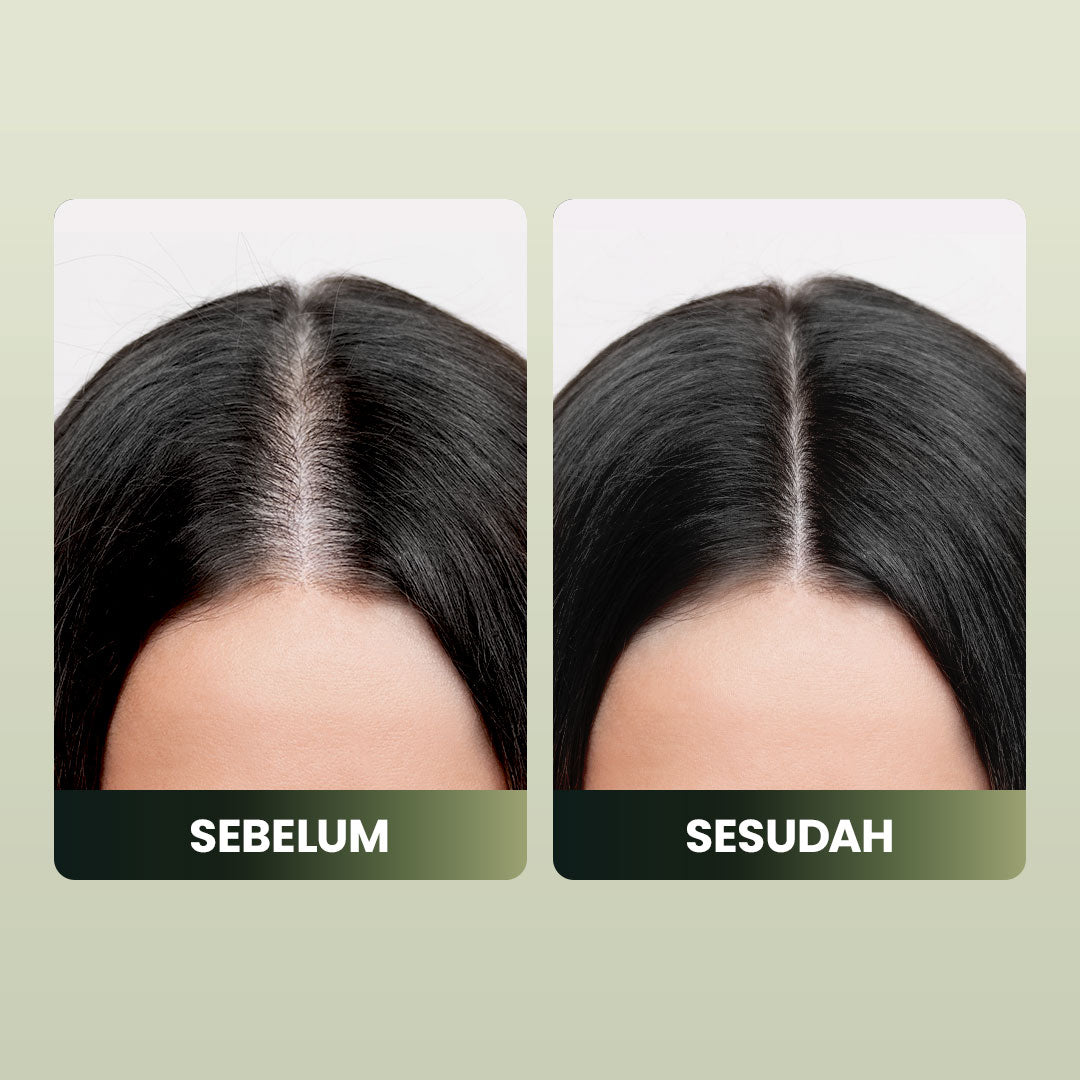 OSWEET Ginger Essence Hair & Scalp Tonic