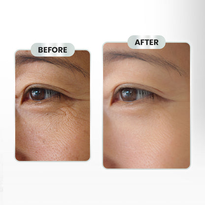 OSWEET Multiple Effect Cream