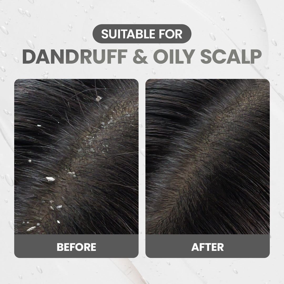 OSWEET Anti-Dandruff &amp; Oil Control Shampoo