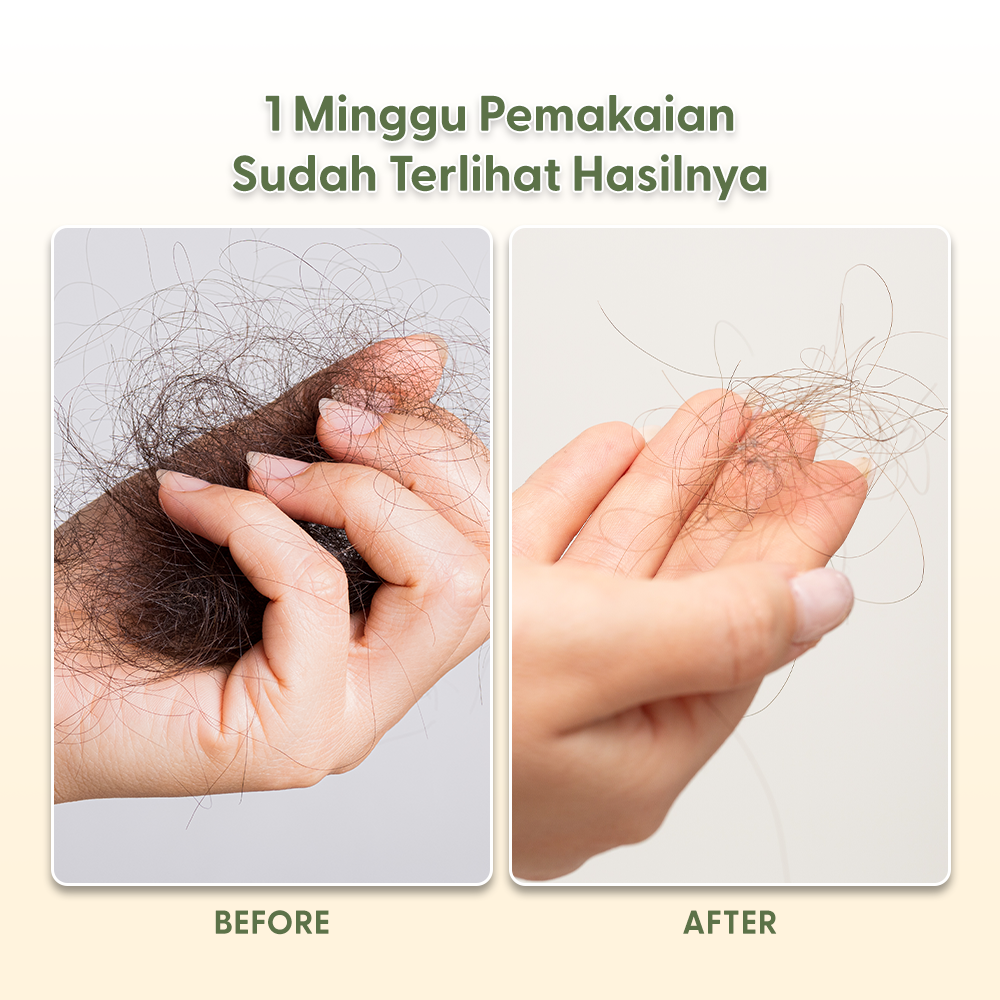 OSWEET Anti-Hair Fall