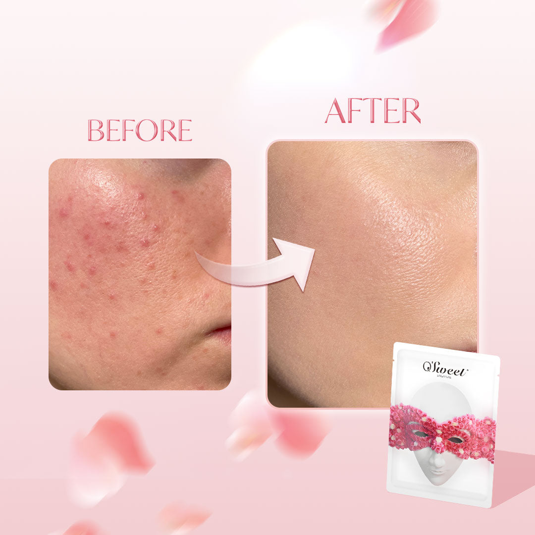 OSWEET Rose Essence Brightening Mask