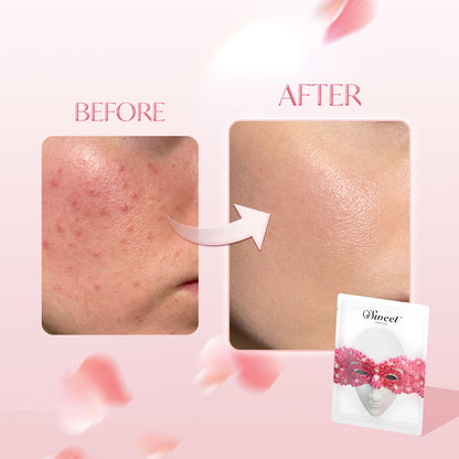 OSWEET Rose Essence Brightening Mask