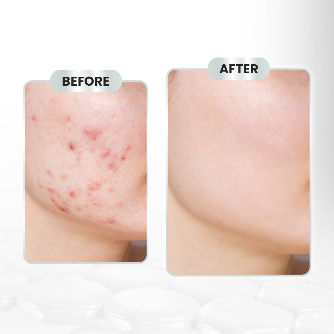 OSWEET Rose Calming Mist Toner